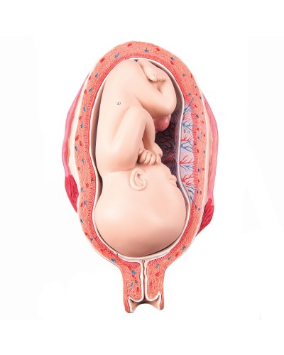 Fetus, month 7